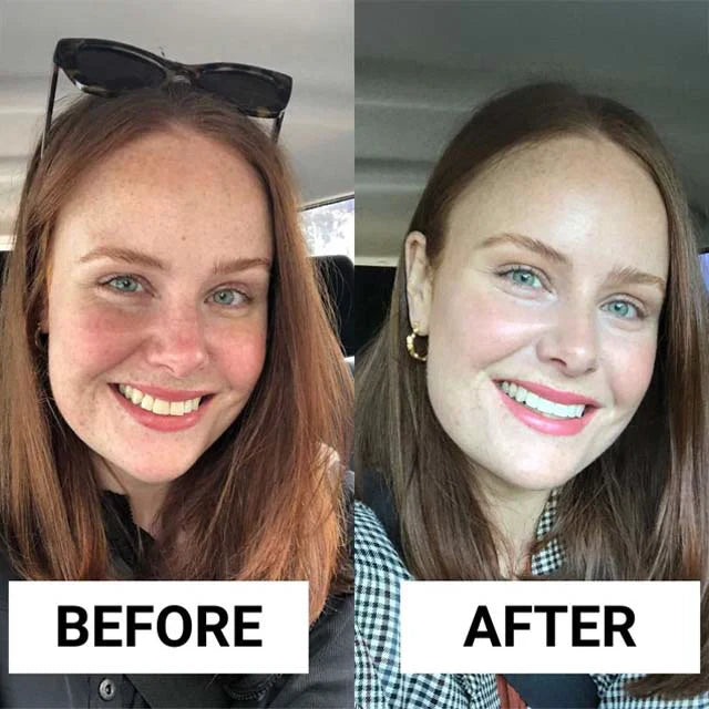 Spearmint Oil Pulling Rinse