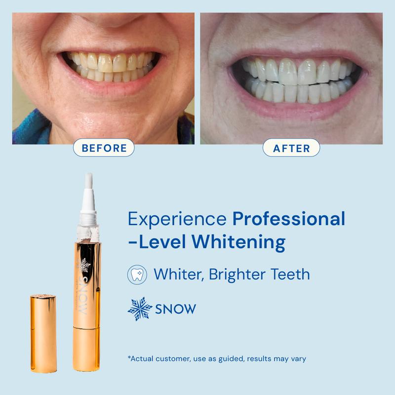 Teeth Whitening Serum Pen