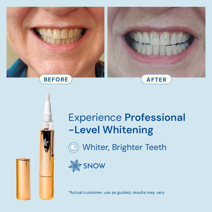Teeth Whitening Serum Pen